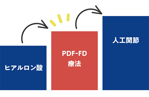 PDF-FD療法