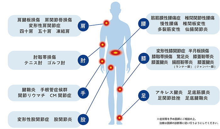 PDF-FD療法の報告例がある疾患